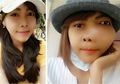 Awalnya Mengira Pipi Bengkak Akibat Sakit Gigi, Wanita Ini Hal Mengerikan Dengan 5 Gejala Ini