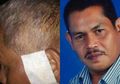 Badannya Bertubi-tubi Dihunjam Parang oleh Tetangganya Sendiri, Darbani, Anggota DPRD Deliserdang yang Baru Terpilih Ini Sama Sekali Tak Terluka, Hanya Jaket Saja yang Koyak
