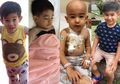Batuk Pilek Biasanya Sembuh Sendiri Tanpa Obat, Eh Diagnosa Dokter Malah Leukemia