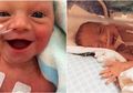 (Foto) Meski Terlahir Prematur, Bayi-bayi Mampu Menunjukkan Betapa Bahagianya Mereka Terlahir ke Dunia, Senyumnya Sangat Manis!