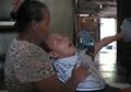 Puluhan Warga di Sebuah Pemukiman di Bali Derita Lumpuh Otak, Apa yang Terjadi?