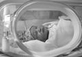 10 Hal Ini Tingkatkan Risiko Moms Melahirkan Prematur, Termasuk Infeksi pada Gusi!