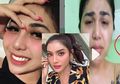 Artis Gebby Vesta Akui Dirinya Transgender: Penelitian Ungkap Operasi ‘Transgender’ Miliki Efek yang ‘Mengerikan’