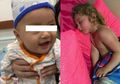 BERITA POPULER: Bocah yang Nyaris Kehilangan Nyawa saat Sedang Tidur Siang serta Bayi yang Ditemukan dengan Mata Penuh Debu
