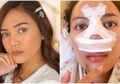 Flu Berbulan-bulan Tak Kunjung Sembuh, Beauty Vlogger Rachel Goddard Jalani Operasi Rekonstruksi Hidung dan Operasi Sinus