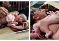 Sungguh Tak Diduga! Berharap Anaknya Lahir Kembar 3, Pasangan Ini Malah Dapat 2 Anak Kembar dengan Salah Satunya dalam Keadaan Seperti Ini!