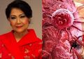 29 Tahun Artis Lawas Ini Sembuh dari Kanker, Tanaman Ini Terbukti Membunuh 98 Persen dalam Waktu 16 Jam!
