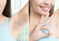 Hilangkan Bulu Ketiak dengan Dicukur, Waxing, atau Laser? Ini Jawaban dari Dokter Kulit Kecantikan