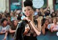 Vitiligo Tak Surutkan Langkah Gadis Ini Jadi Top Model Dunia