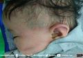 Jika Muncul Tanda-tanda Berikut Saat Anak Mual Muntah, Jangan Dianggap Biasa