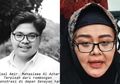 Tak Terima Putranya Jadi Korban Bentrokan Demo Hingga Alami Pendarahan Kepala, Ibunda Faisal Amir Mahasiswa Al Azar Tuntut Komnas HAM untuk Mengusut Pelaku: Saya Maafkan