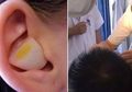 Memiliki Masalah Tidur, Pria Ini Tirukan Solusi Unik Memasukkan Bawang Putih ke Telinganya, Namun yang Terjadi Berikutnya Membuatnya Panik!