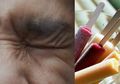 Seorang Gadis Berusia 11 Tahun Berhasil Selamat dari Aksi Pemerkosaan Berkat Batang Es Krim