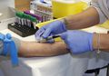 Berbohong Tak Pernah Berhubungan Intim Sebelumnya, Setelah Donorkan Darahnya Ternyata Pria Ini Ketahuan Positif HIV
