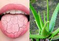 Merasakan Mulut Kering? Coba 5 Obat Rumahan Ini untuk Meringankannya, Salah Satunya dengan Lidah Buaya