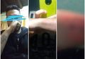 Ingin Masuk Kepolisian, Pemuda Ini Nekat Hapus Tato dengan Cara Sederhana Terinspirasi dari Video Tutorial, Tapi Begini Jadinya