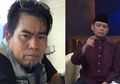 Sampai Disuruh 'Garuk-garuk' Kuburan Orangtua Untuk Minta Maaf, Ternyata Ini Penyakit Yang Diderita Bopak Castello