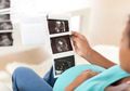 Mengenal Mirror Syndrome yang Sebabkan Irish Bella Kehilangan Calon Anak Kembarnya