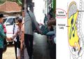 Breaking News: Ternyata Wiranto Kena 2 Tusukan Sajam, Sampai Menembus Lapisan Peritoneum, Mengancam Jiwa Menko Polhukam