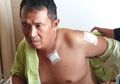 Kisah Heroik Kapolsek Menes Lindungi Wiranto dari Tusukan, Korbankan Kedua Lengannya Hingga Bercucuran Darah Masih Harus Jalan Sejauh 500 Meter Cari Bantuan