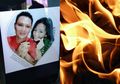 Dibakar Hidup-hidup Oleh Suami yang Baru Saja Dinikahinya, Nasib Putri Kini Memperihatinkan, Alami Luka Bakar Sampai ke Saluran Napas