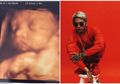 Belum Ada Kabar Menikah Sama Sekali, kok Tiba-tiba Rapper Kontroversial Ini Unggah Foto Janin Buah Cintanya dengan Kekasih, Netizen Kepo