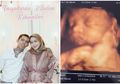 Young Lex Bikin Geger! Kabar Nikahnya Tak Terdengar tapi Langsung Pamer Potret 7 Bulanan, Warganet: 'Mualaf ya Bang?'