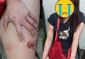 Paha Wanita Cantik Ini Digigit oleh Perampok yang Gagal dan Kabur ke Pasar Rame Medan, Begini Kronologinya