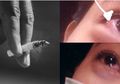 Viral Seorang Wanita Jadi Korban Perokok Egois di Jalan Raya, Begini Kondisi Kornea Matanya yang Terpapar Bara Rokok!