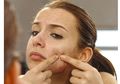Cara Menutupi Jerawat Batu dengan Makeup yang Mudah, Coba Triknya Yuk!