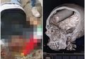 Seorang Demonstran Ditemukan Tewas dengan Tabung Gas Air Mata Bersarang di Dalam Otaknya