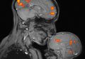 Foto MRI Otak Ini Diklaim Jadi 'Bukti' Begitu Eratnya Kasih Sayang Ibu dan Anak, Kok Bisa?