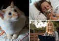 Dicakar Kucing Peliharaannya, Wanita Ini Koma hingga Harus Jalani Cangkok Kulit