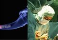 Rokok Hambat Penyembuhan Luka Pasca Operasi Bahkan Memicu Komplikasi