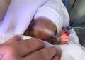 Lahir dengan Berat 0,7 Kg, Bayi Terkecil Ini Divonis Tak Dapat Bertahan Hidup hingga Akhirnya Mukjizat Datang Padanya