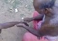 Praktik Miris Seorang Dukun Tradisional, Hanya Gunakan Silet dan Daun Untuk Mengobati Korban Terkena Gigitan Ular
