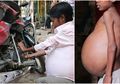 Kisah Mekanik Sepeda Alami Kondisi Misterius hingga Perutnya Terus Menggelembung, Dokter pun Tak Bisa Mendiagnosis Penyakitnya
