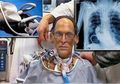 Divonis Dokter Umurnya Tinggal 12 Jam, Pria ini Pilih Hidup Tanpa Jantung dan Digantikan Alat Modern ini!