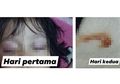 Viral Mata Anak Ini Keluarkan Cairan Mirip Nanah Diduga Karena Radiasi Ponsel, Benarkah? Ini Jawaban Ahli!