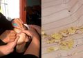 Mata Seorang Gadis Alami Gangguan Penglihatan karena Di-bully oleh Teman-teman Sekolah, Kepala Sekolah: Mereka hanya Bersenang-senang!