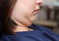 Bikin Nggak Percaya Diri? Ini 4 Cara Ampuh Menghilangkan Double Chin