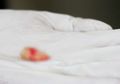 Mengeluh Hidungnya Mampet Tapi Kerap Mencium Bau Busuk Aneh, Ternyata Selama 20 Tahun Ada 'Benda Berlendir' Ini yang Menyumbat Lubang Hidung Pria Tersebut
