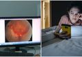 Menatap Layar Ponsel Terlalu Lama Mata Wanita Ini Meledak, Dokter Ungkap Hal Mengerikan yang Terjadi Pada Matanya Sebelum dan Setelah Meledak