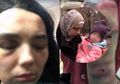 Dijadikan Budak Nafsu oleh Suami Sendiri dan Dipukuli di Depan Anak-anak, Begini Nasib Perempuan yang 'Dikurung di Neraka,' Simak Pengakuannya
