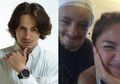 Mukjizat yang Dialami Dylan Carr Pasca Sembuh Dari Kecelakaan Maut, Dokter yang Merawat Pacar Angel Gilsha Mengaku Kaget Melihat Kondisinya