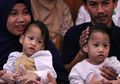 Bayi Kembar Siam Asal Kendari Yang Berhasil Dipisah Oleh 70 Dokter Belum Diperbolehkan Pulang ke Rumah