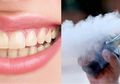 Sama Dengan Rokok Biasa, Vape Juga Bisa Buat Gigi Kuning