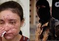 Kisah Pilu Mantan Budak Nafsu ISIS, Hidup Kelaparan dan Hanya Bisa Makan Daging, Tak Disangka Daging Itu Adalah Anaknya Sendiri