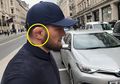 Mirip Sayur Kol, Ini 3 Fakta Menarik Di Balik Keanehan Bentuk Telinga Khabib Nurmagomedov