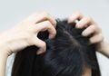 Cara Menangani Berkurangnya Rasa Percaya Diri Karena Ketombe dan Rambut Rontok